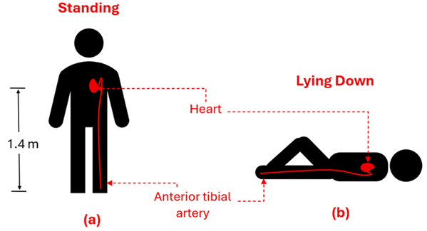 An illustration of a person (with their heart shown and an artery to the foot) is shown in standing (A) and lying down (B).  The distance from the heart to the bottom of the artery is 1.4 meters.  When lying down, the height will be 0 meters.